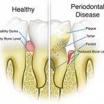 preventive and Conservative Dentistry- Gum Disease Therapy